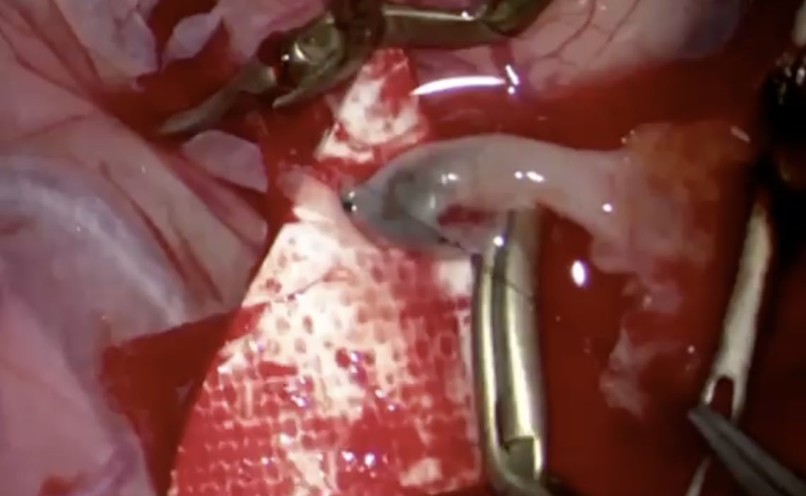 د/ محمد هاني عارف Mohammed Aref, MD tweet media