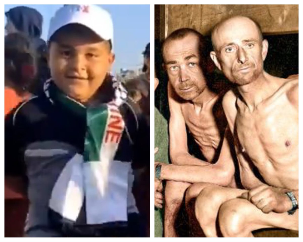 You ever notice there’s no pictures of children from the WWII concentration camps that were liberated? It’s because they were all dead. 
I can only compare this fat little Palestinian to the living men who survived a real holocaust.