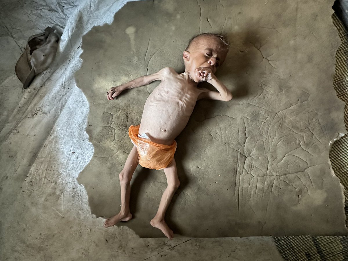 The NYT and the Free Press went into a weeklong meltdown, arguing that an image of a young boy named Muhammed wasn’t a fair representation of the terror of starvation in Gaza. 

We spoke to the family and they shared before and after photos that make it thoroughly clear it was