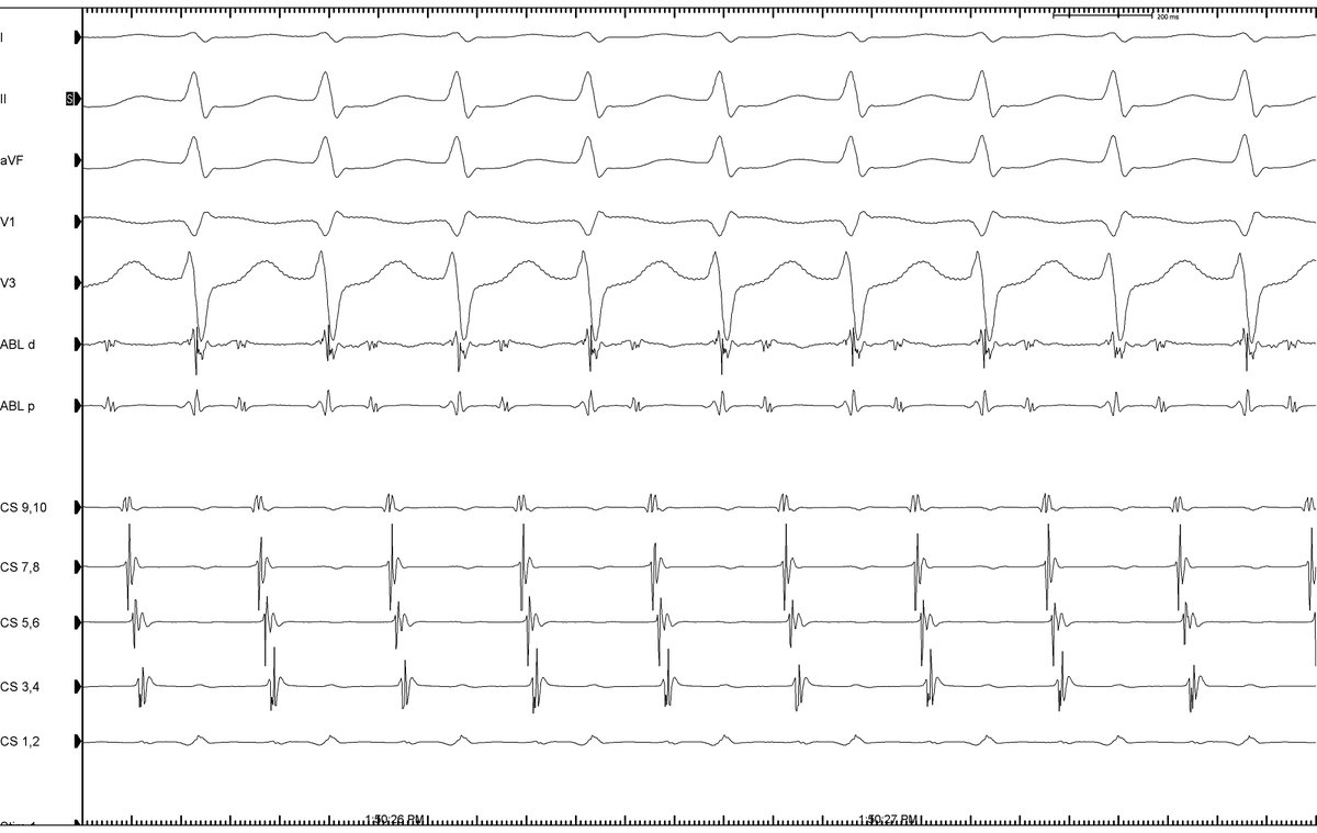 A_Jaouadi tweet media