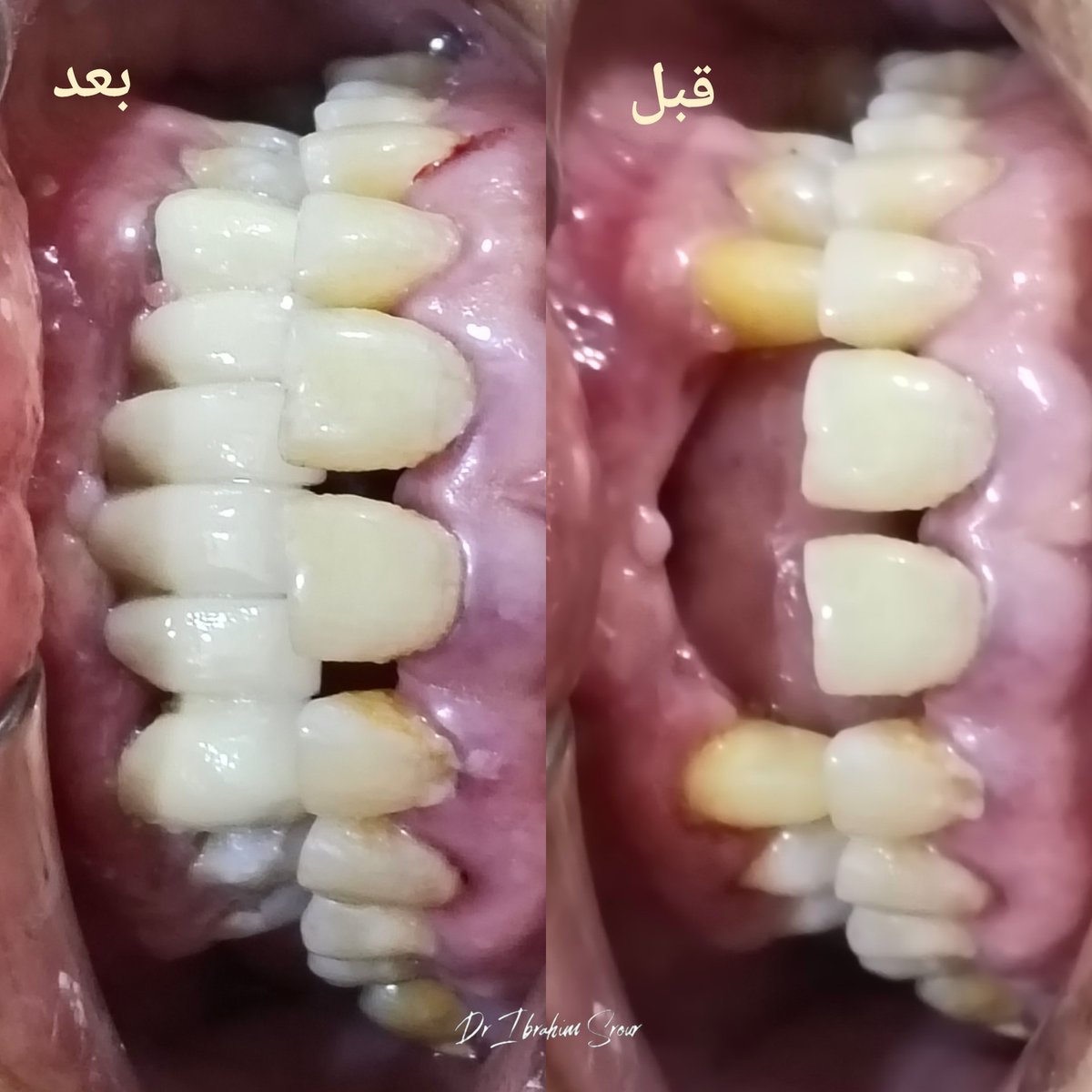 Ebrahim srour (@srour_ebrahim) on Twitter photo 
