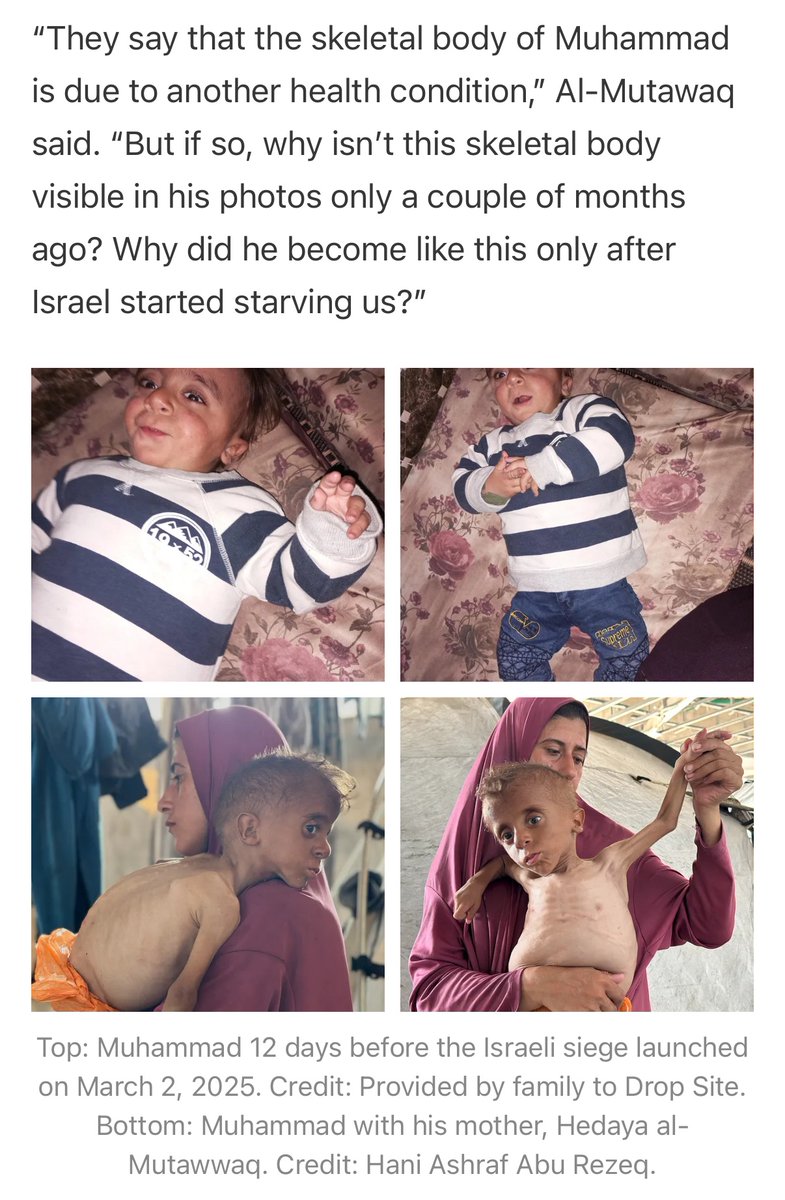 NathanJRobinson's tweet image. Drop Site News has now exposed the reporting of Bari Weiss’s Free Press as a FRAUD. FP claimed starving children in Gaza actually looked sick because of prior health conditions. Drop Site tracked down families who gave before and after photos that show Bari was lying.