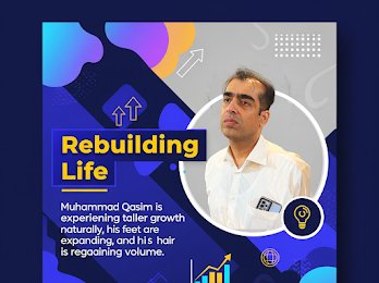 Once discouraged by baldness, Muhammad Qasim now serves as  proof that healing can still happen.Muhammad Qasim