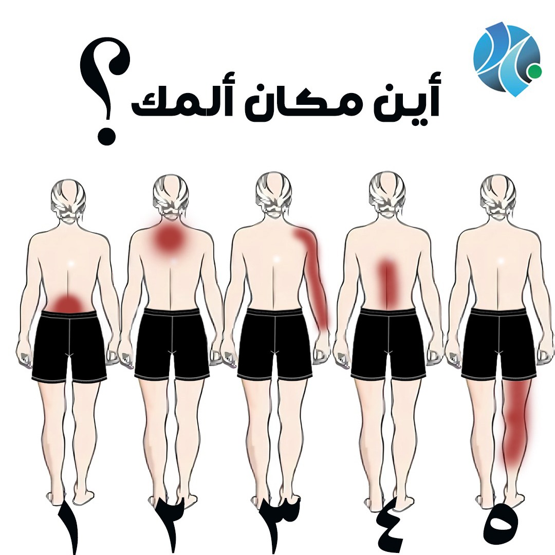 شاركنا مكان ألمك ؟