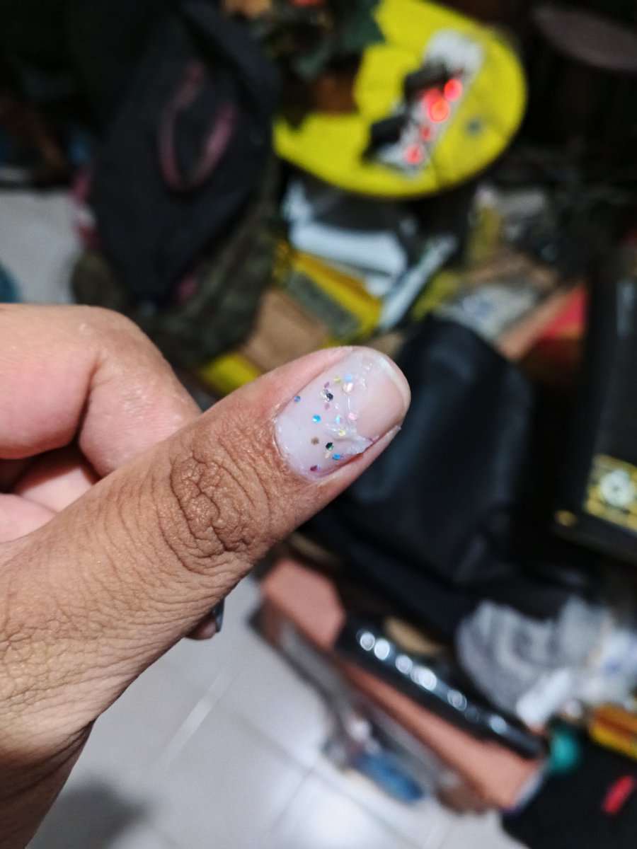 arbytyn's tweet photo. kuku jadi percobaan bojoku di ohsome. trs abis berak jadi begini, ini glitter nyangkut di bol gak kira2? https://t.co/vAcdMpGCQQ