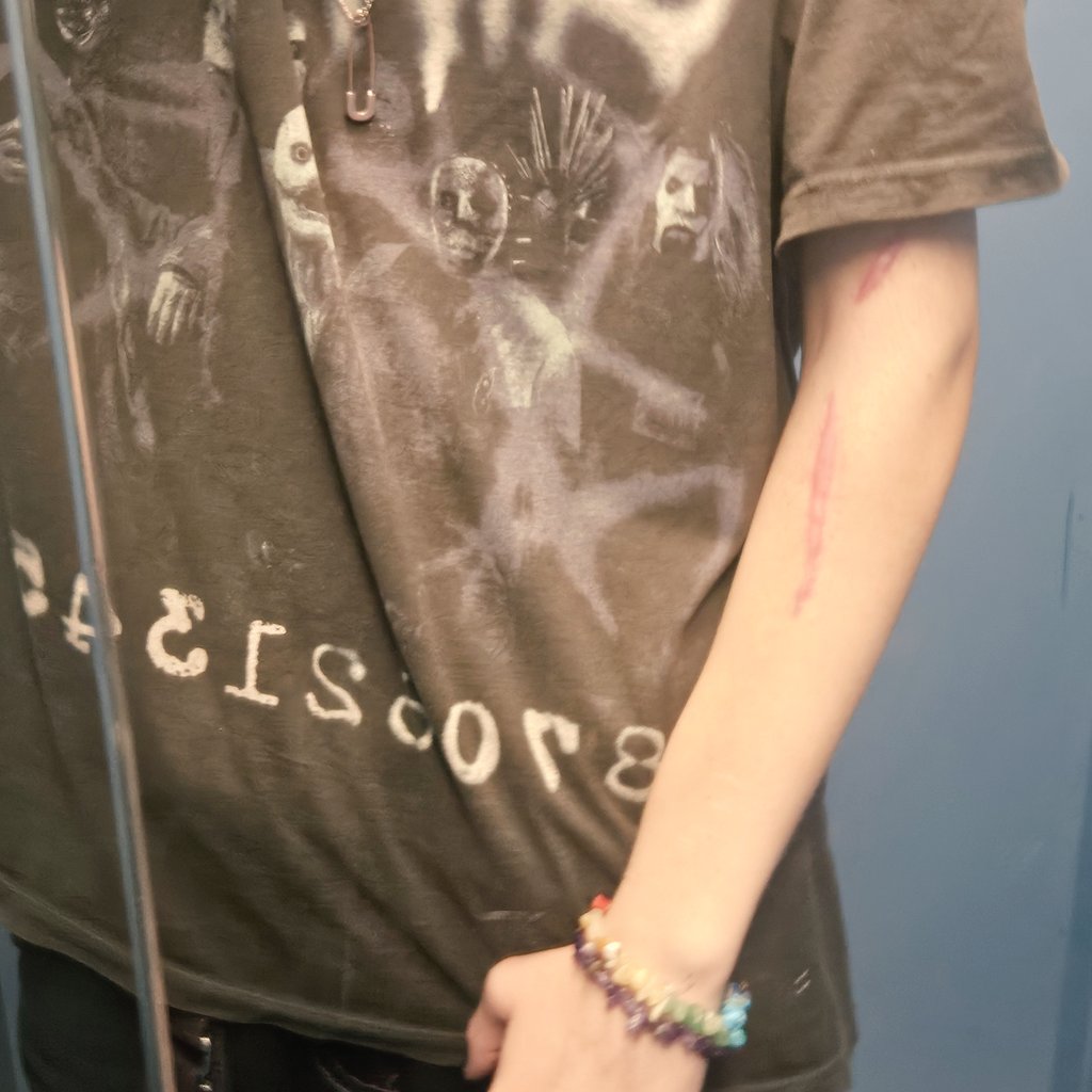 spodeath's tweet image. if you saw my scars in public would you be uncomfy? i hate them. i feel like i'll never be able to wear short sleeves irl anymore