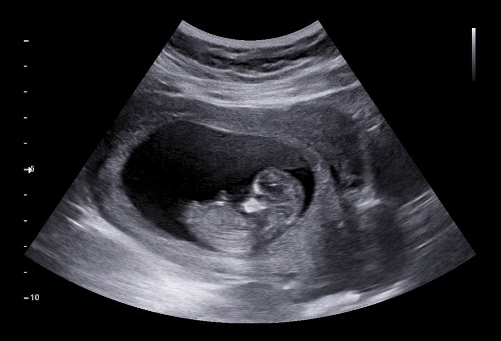 Just helped this 26 week old fetus hit $25k MRR with his coaching offer

Not even born yet and he’s on track to hit $1 million in income by next year 

And people still think my course is a scam 🤦‍♂️
