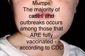 JenCommon's tweet image. More than 90% of the mumps cases in America are in people vaccinated against Mumps. The survival rate for a healthy American child is 100%. 

Why are we forcing babies to take these poison vaccines? 

Source: Forbidden Facts, Chapter 11 by Gavin de Becker