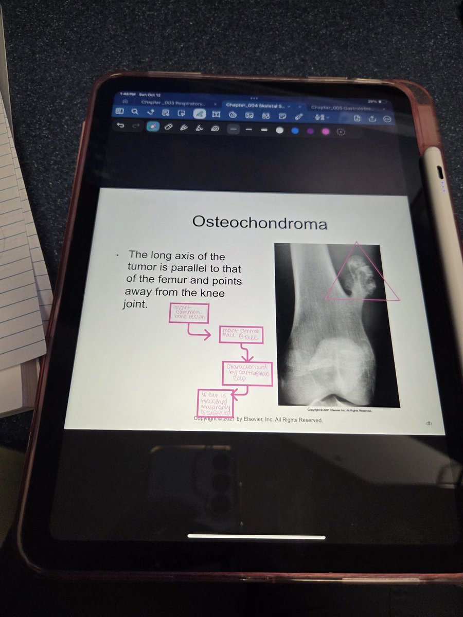 amorsitoo143's tweet image. Studying on my downtime at work. 6 months to go 🫶🫣✨️

#PositivelyOC #Radtechstudent