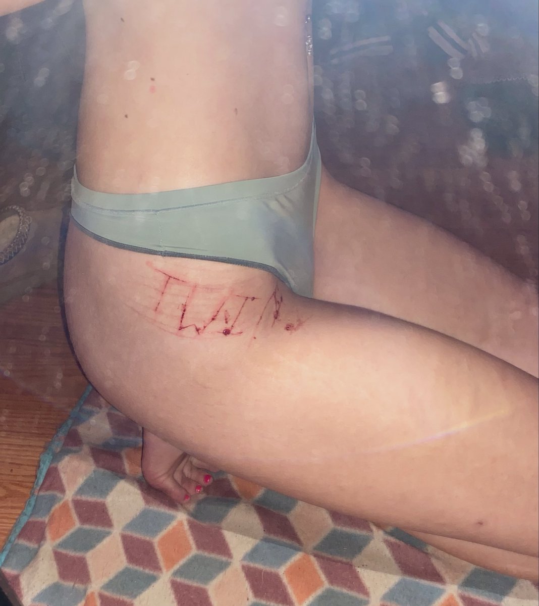 longlivepatchy's tweet photo. i can do better🥲 #shtwt #selfharmtw #SELFHARMTRIGGERWARNING #TWIN https://t.co/XRx0fOpsku
