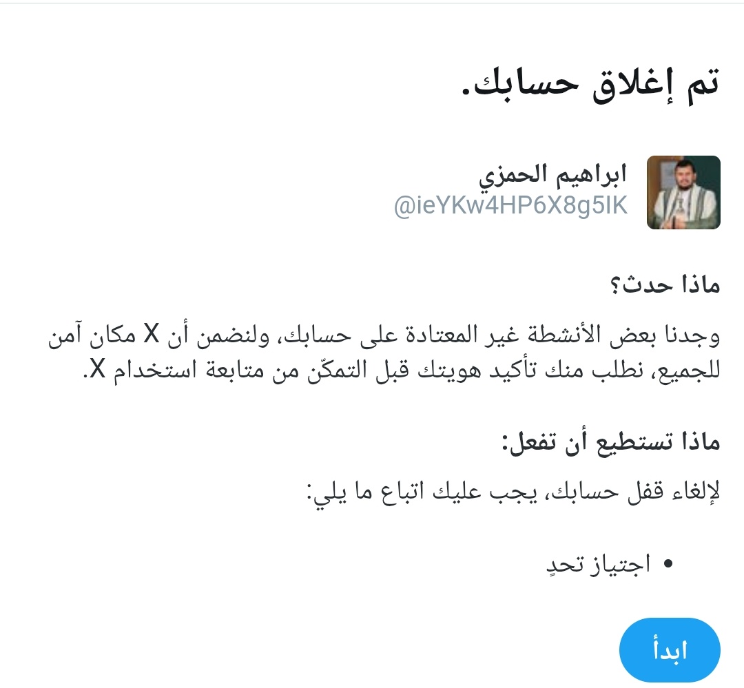 حسابي مصفر بسبب بلاغـ.ـات بعـ.ـران ولي العـ.ـهر.. 

مـمـكــــــــن فزززززززززعة <a href="/ieYKw4HP6X8g5IK/">ابراهيم الحمزي</a>