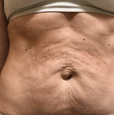 hollowearthterf's tweet image. This is a very dishonest way to ask this. How about instead you actually post pictures of postpartum bodies and ask men if they find it attractive