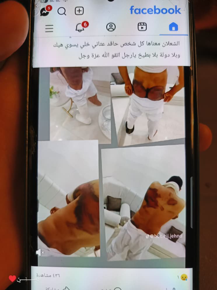 syr00101's tweet photo. @DeirEzzore زين بعتلك رسالة عالخاص عن الأمن العام عن يعذبو ناس مشان ثارات https://t.co/EUS6HirPnw