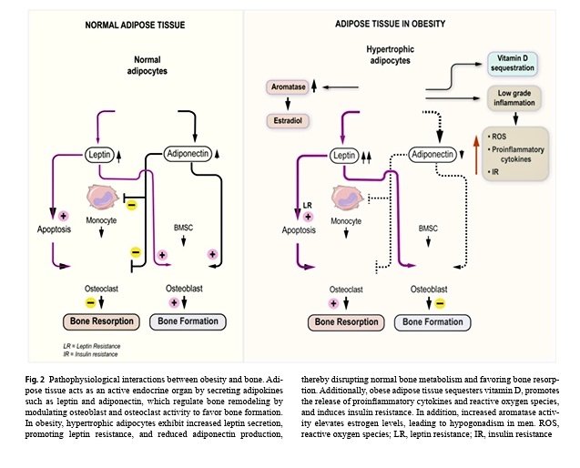 Esta revisión explora como la obesidad y las intervenciones para bajar de peso (nutrición, ejercicio, fármacos, cirugía) afectan la salud ósea. Analiza como el peso afecta los patrones de fracturas en los pacientes. 🧵