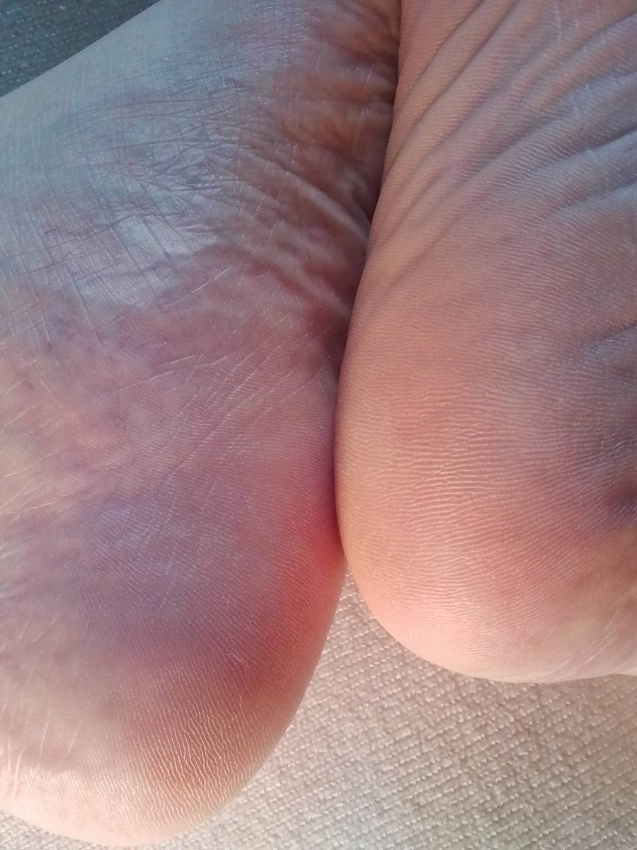 ゆうま🦁 (@yumapet) / Posts / X