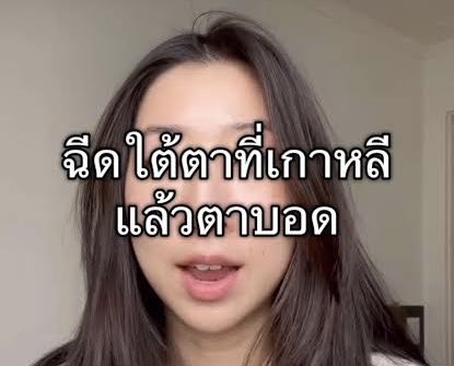 คหสต คนที่คิดจะไปทำหน้าเกาหลี อยากเขย่าตัวให้คิดเยอะๆ

-คลินิกเกาหลี*ส่วนมาก* ทำงานโรงงาน; ปรึกษากับเซลล์ คลีนหน้า(เองบางที) แปะยาชา เจอหมอคือจิ้มเลยแทบจะไม่ได้ปรึกษาหมอ แล้วหมอคือทำเวลามาก มือหนัก ไม่กลัวคข.เจ็บ

-ยา-เครื่องเกาหลีหลายตัวที่นู้นถูกกว่า ไม่เถียง เพราะผลิตในเกาหลี