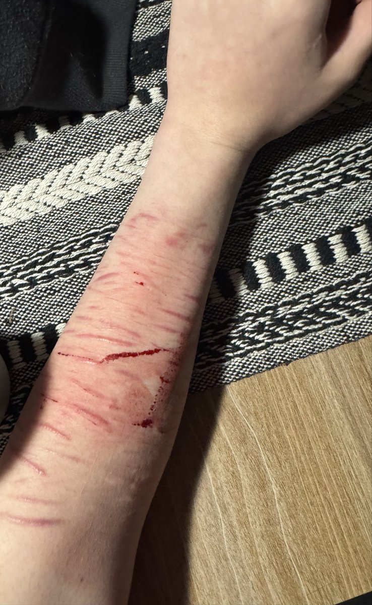 VAL🦄 (worlds worse anorexic) tweet media