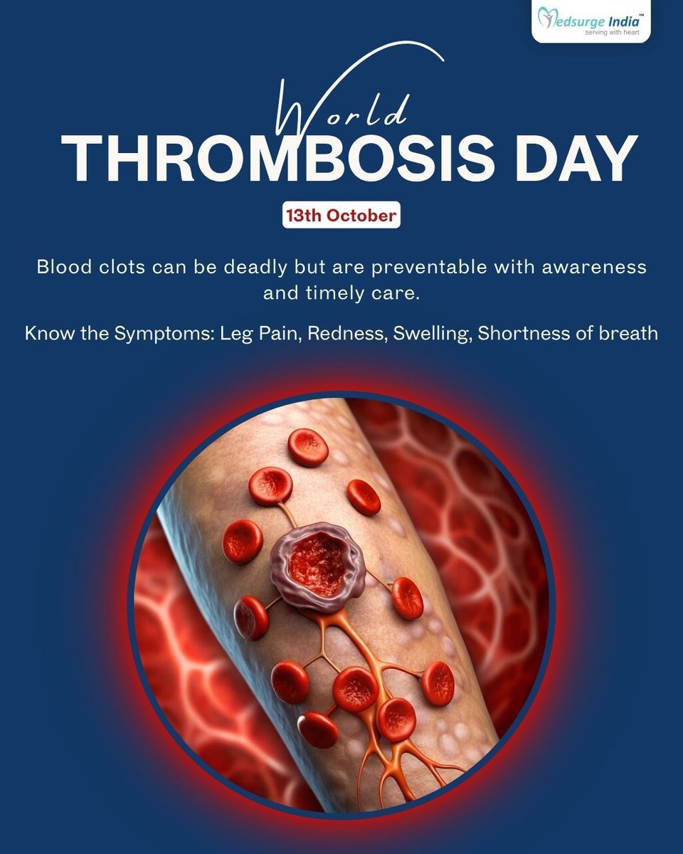 Thrombosis occurs when blood clots block veins or arteries, leading to serious conditions like DVT, heart attack, or stroke. Watch for signs like leg pain, swelling, redness, or sudden shortness of breath and #chestpain—these could be warning signals.
#WorldThrombosisDay #Health