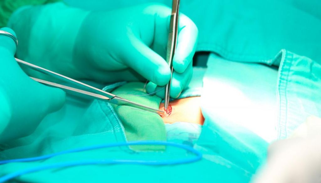 DiarioSaludDo's tweet image. Desarrollan hidrogel que promete prevenir complicaciones tras la cirugía abdominal
diariosalud.do/noticias/desar…
@cdcird 
@cmdorg 
#diariosalud
#noticiasdesalud