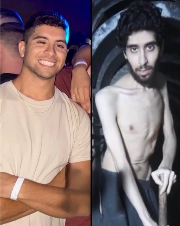 🚨🚨ÚLTIMA HORA🚨ISRAEL
EVYATAR DAVID, secuestrado del Nova Music Festival el 7 de octubre de 2023.
Retenido por los yihadistas de Gaza durante dos años bajo tierra, con poca comida y sin luz natural, torturado, obligado a cavar su propia tumba.
YA ESTÁ DE VUELTA A CASA‼️