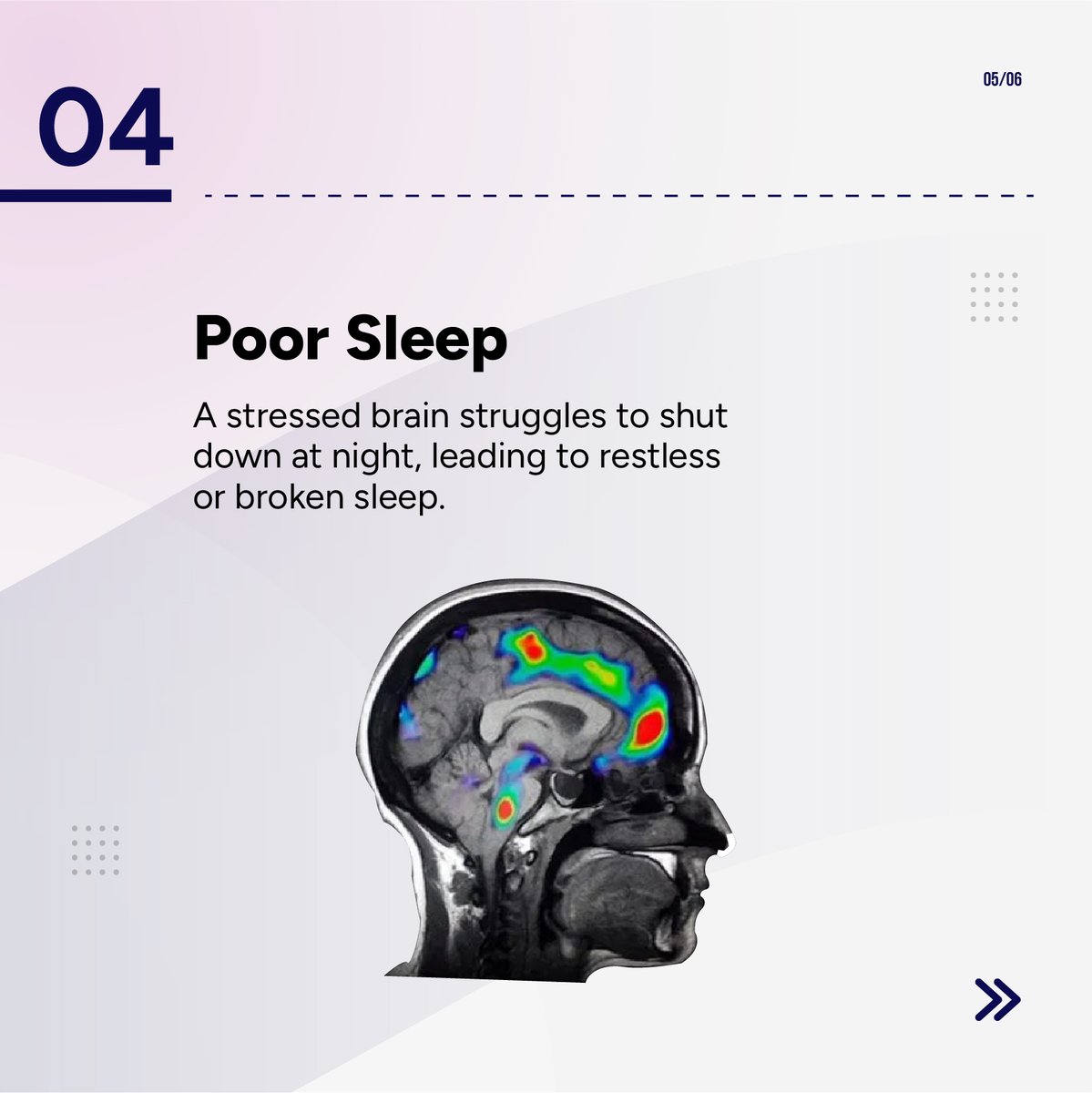 IQMINDInc's tweet photo. 4 Signs Your Brain is Stuck in Survival Mode!

Save this if you relate to 2+ signs.

#SurvivalMode #EmotionsandNeuroscience #Iqmindinc #BrainHealth #braintuneup #FightOrFlight #StressRelief #CalmTheMind #MindsetMatters #BrainOptimization #MentalClarity #AnxietyRelief https://t.co/wd5e0xBmdU