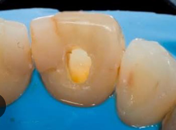 aku koas gigi yang mau dirawat boleh dm tweet media