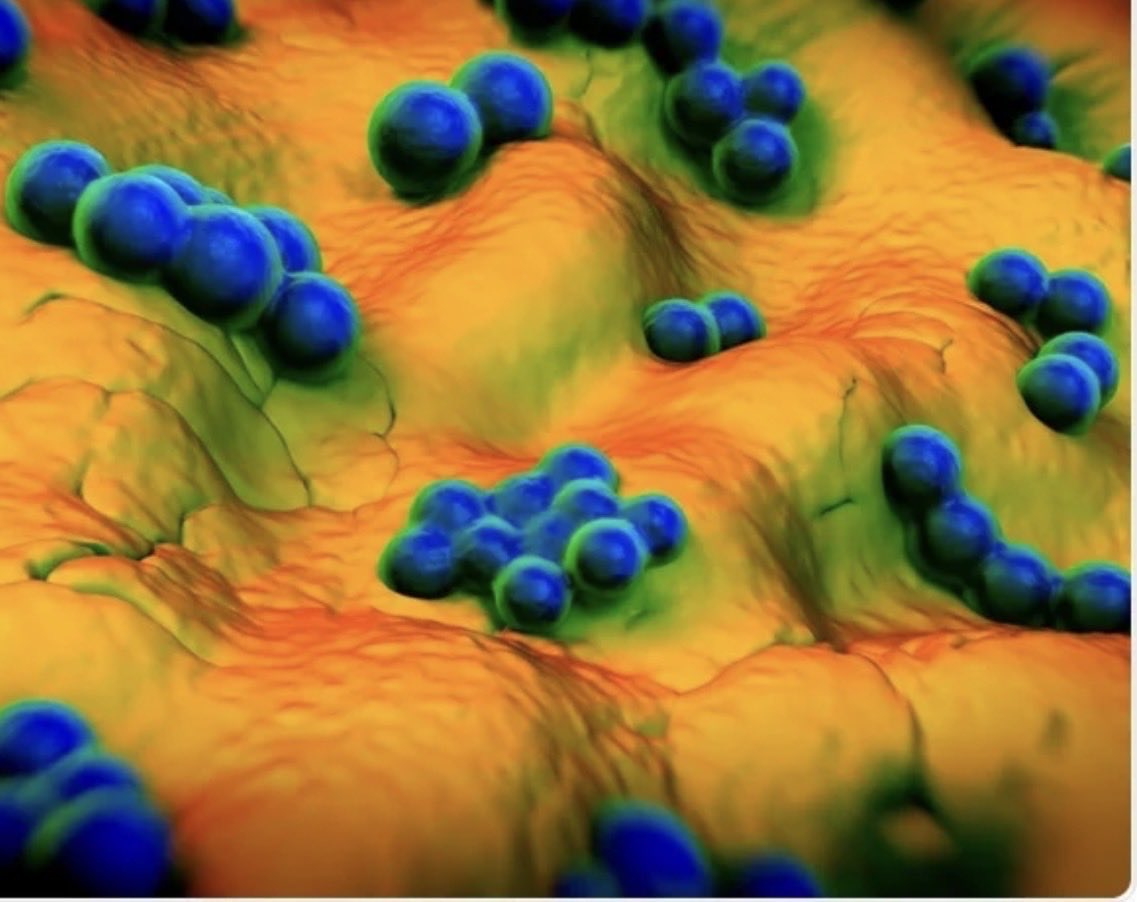 New WHO report: The post-antibiotic era isn’t coming — it’s here.
🦠 1 in 6 infections now resists treatment.
📈 Resistance is rising 5–15% per year, outpacing modern medicine.
💊 Even our “last-resort” drugs are failing — and deadly Gram-neg superbugs are on the rise.

⏰ The