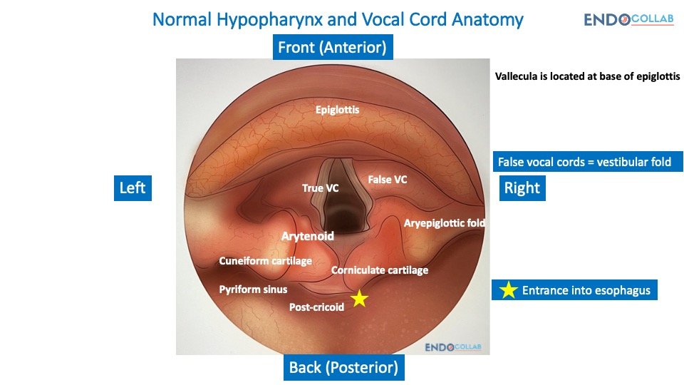 The best guide to investigation of the hypo pharynx and larynx during EGD