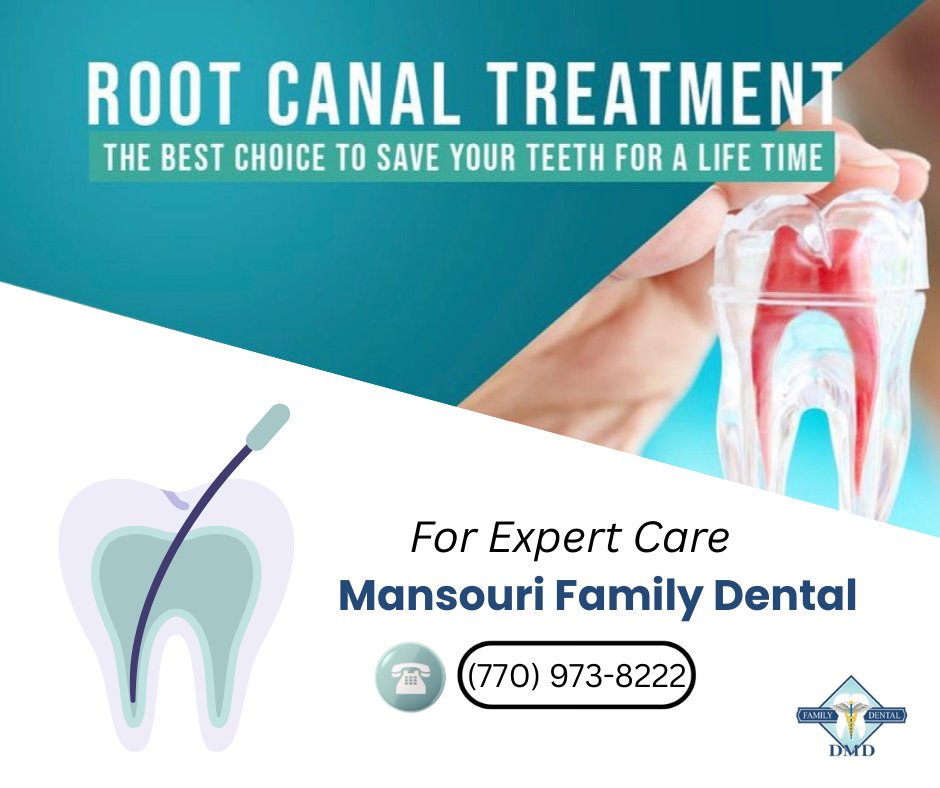 When infection reaches the pulp of your tooth, extraction isn’t your only option. A #rootcanal can remove the infection, relieve pain, and preserve your natural tooth for years to come.

📅 Tooth pain isn’t something to ignore. Let’s save your smile—one root at a time.