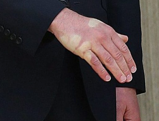 drefanzor's tweet image. Macron's hand after Trump manhandled him 😂