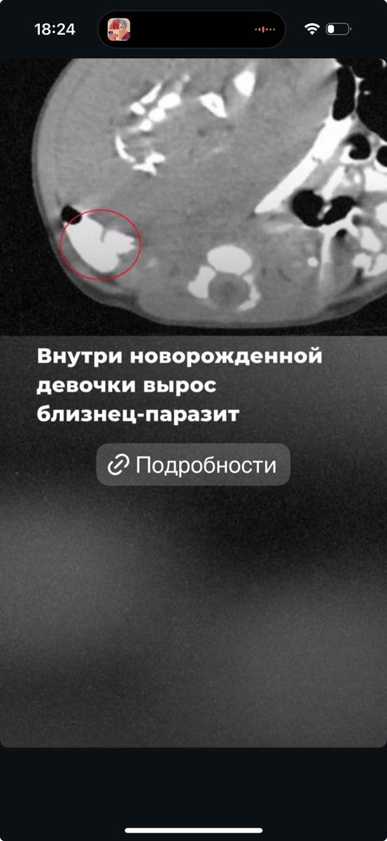 у кого было