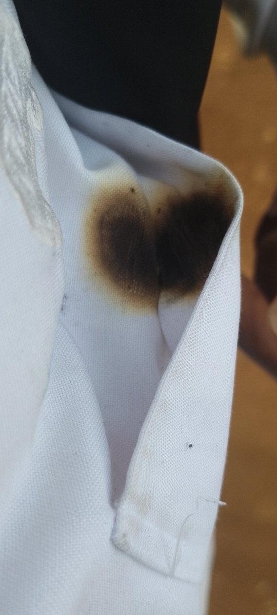 outstandingnerd's tweet image. A 21yr old Kenyan Gen Z almost got severely burned by a marijuana blunt which he left on without knowing and wrapped it with a piece tissue paper 🌡️