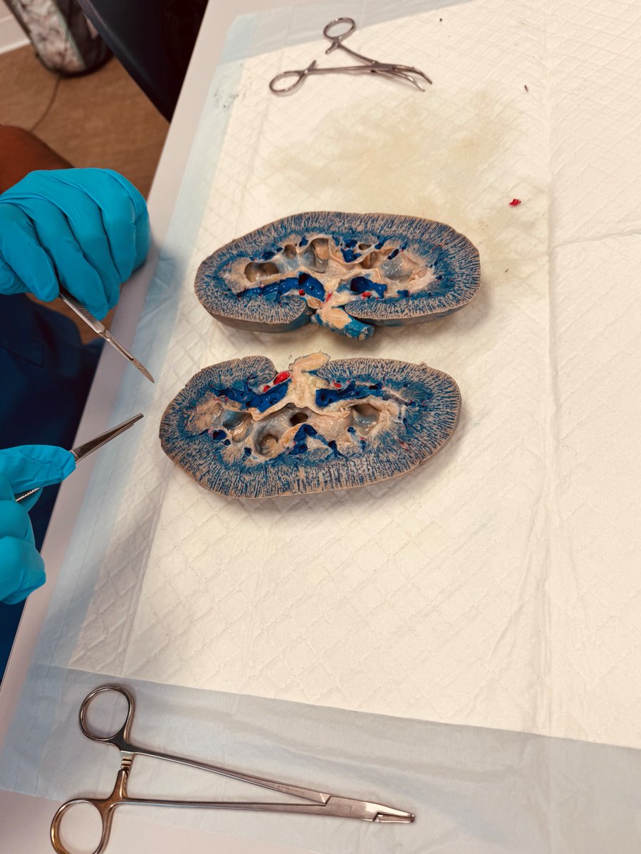 SECEducation's tweet image. Take a look at our North Charleston Surg Tech students gaining hands-on experience! They’ve been diving into the importance of Anatomy &amp;amp; Physiology while exploring how the human body works. #SurgicalTechnology #HandsOnLearning #FutureHealthcareHeroes #WeAreHireEd #SECPride