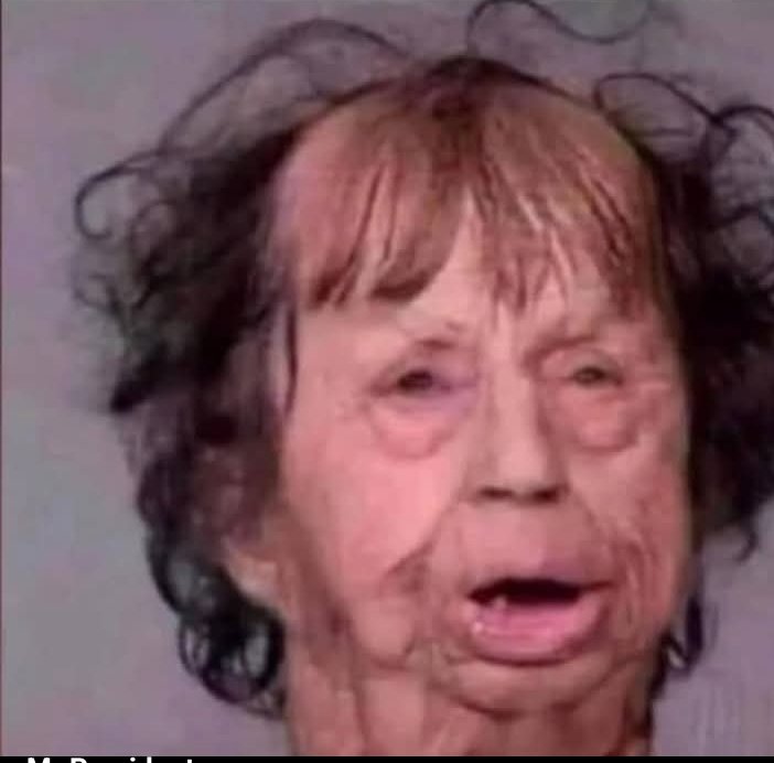 Men will complain about women stretch marks, while their ball looks like this 😭