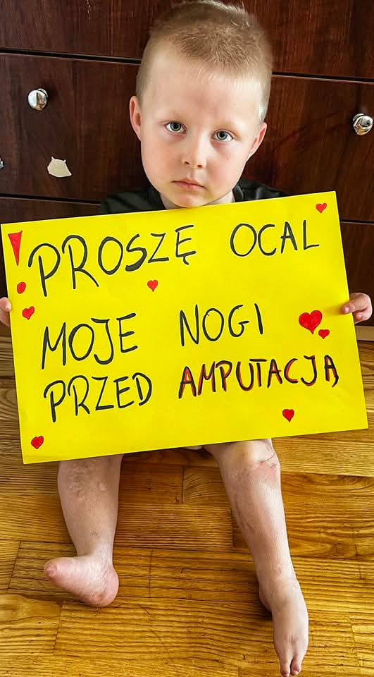 PILNE ❗️Wielka prośba o RT 🙏
Bez PILNEJ operacji w Stanach Zjednoczonych utną moje nóżki.

Gdyby każdy z Was odmówił sobie kawy lub lodów, ja miałbym szansę na normalne ŻYCIE. Nie bądź obojętny, ta zbiórka to ratunek na życie bez bólu. To życiowa szansa abym stanęł na zdrowe