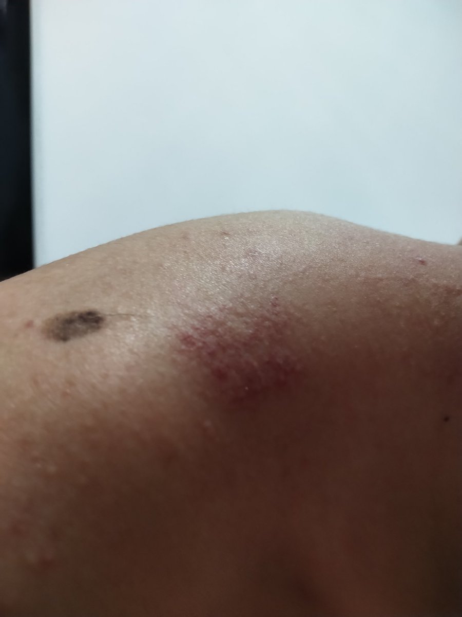 呃为了保护粉丝隐私那个视频先不发了，把图2和3粉丝夺舍的图and 被我种草莓的图放出来就行了