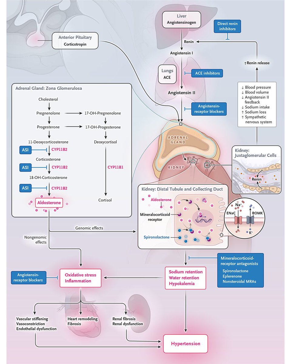 Nephro_Ivan's tweet image. Excelente imagen que resumen la fisiopatología y blancos terapéuticos de fármacos anti hipertensivos incluyendo los nuevos inhibidores de aldosterona sintetasa (Baxdrostat) 💊💊💊
👏🏻👏🏻👏🏻👏🏻
👇🏻👇🏻👇🏻👇🏻
@NEJM