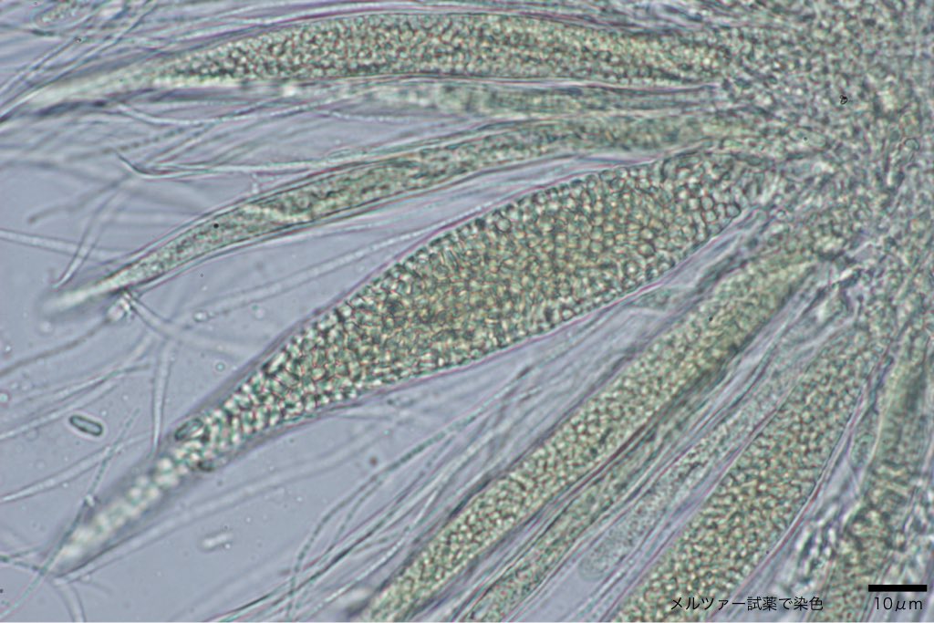 Thelocarpon sp. 子嚢に無数の胞子が詰まっている