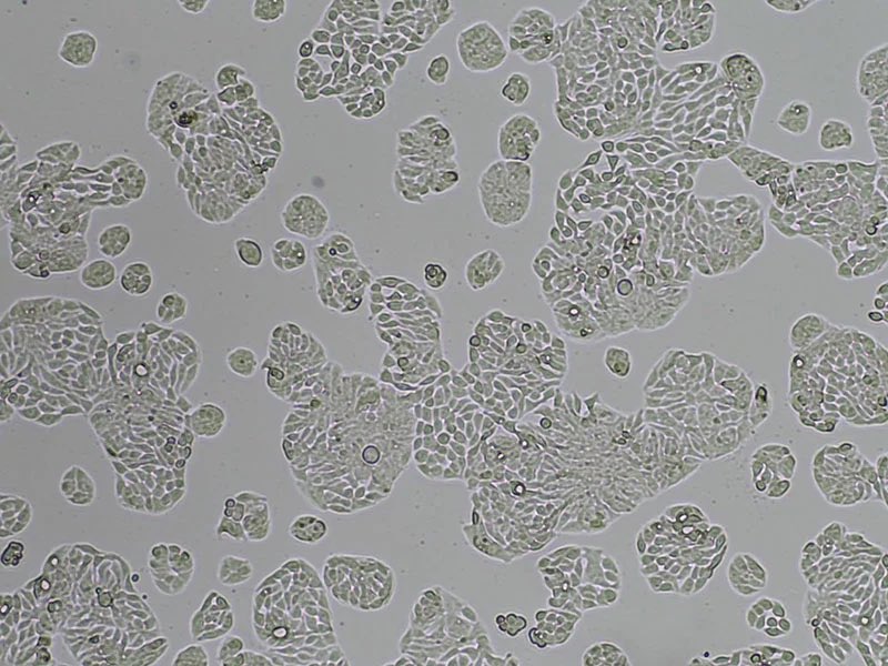 accegen's tweet photo. Meet HT-29, a trusted model for colorectal cancer and intestinal research.
It forms polarized epithelial layers with tight junctions &amp; microvilli, ideal for
🔹 Drug absorption assays
🔹 Microbiome studies
🔹 3D tumor models

https://t.co/RRAPzsbyC2

#HT29 #AcceGen #CancerResearch https://t.co/uXmYV6VGZ1