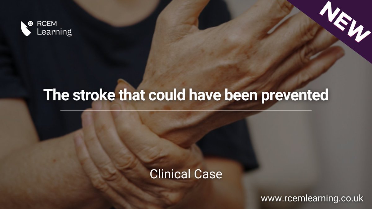 RCEMLearning's tweet image. NEW: A 72-year-old with atrial fibrillation presents with left-sided numbness. Initial Examination and Laboratory investigations are unremarkable.
Read our latest #ClinicalCase here: rcemlearning.co.uk/modules/the-st…