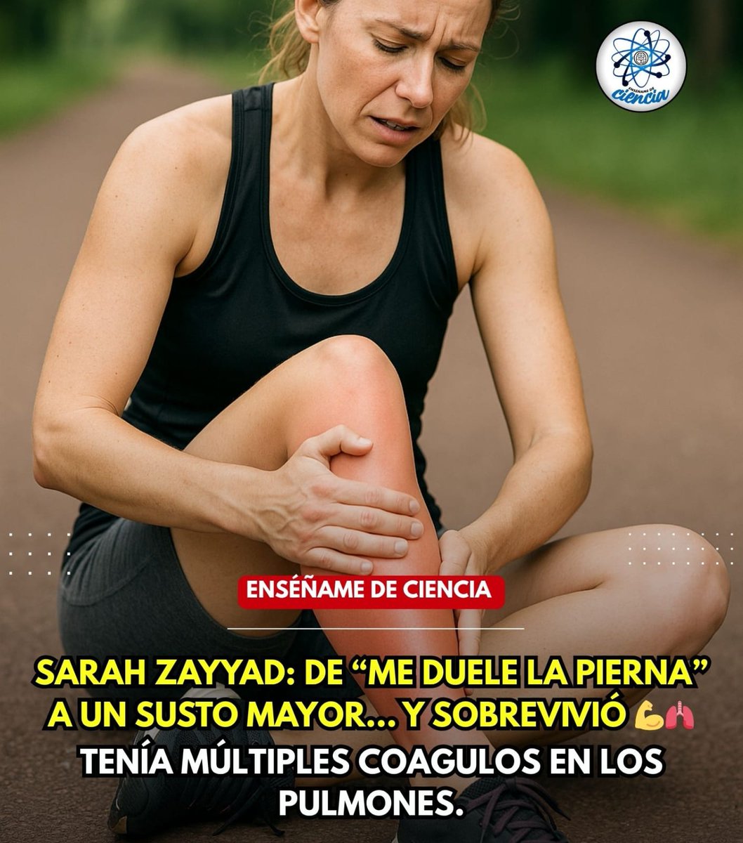 ⚠️ PRESTA MUCHA ATENCIÓN A ESTE CASO.

Todo empezó con un dolor fuerte en la pierna. Pensó que era un tirón, pero el dolor empeoró, comenzó a cojear y su pierna cambió de color. En el hospital le hicieron un ultrasonido y hallaron una trombosis venosa profunda (TVP). 

🫁Un
