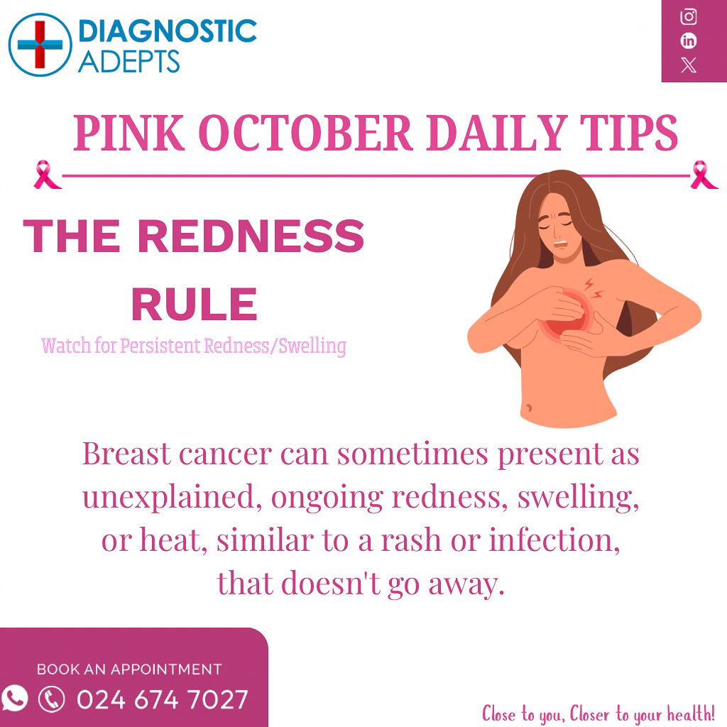 d_adepts's tweet photo. Persistent breast redness or swelling that doesn’t fade could be more than irritation, it might be an early sign of breast cancer.
Stay alert, check often, and act early. 

Early detection saves lives. 💖

📞024 674 7027

#PinkOctober #BreastCancerAwareness #DiagnosticAdepts https://t.co/sTvO2tCuZw