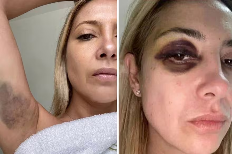 RoCrisne1's tweet photo. @Angelalerena Con Fabiola no era tan URGENTE no? https://t.co/9ckCKtVZvz