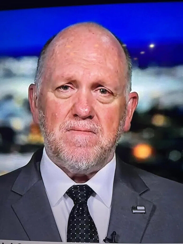 AuntSassyAss's tweet image. Poor Homan. He looks like he ingested bottles of Tylenol in-vitro and had a failed circumsion twice 😳