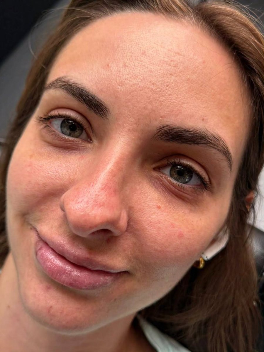 Check out this before and after of a signature lash lift and tint by Better Brows! 😍