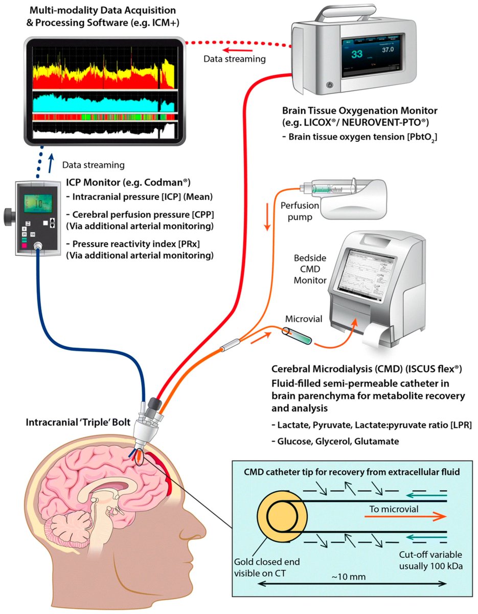 Traumatic Brain Injury: Advances in Diagnostic Techniques and Treatment Modalities 

CCR Journal Watch - tracking the critical care literature daily
criticalcarereviews.com/latest-evidenc…