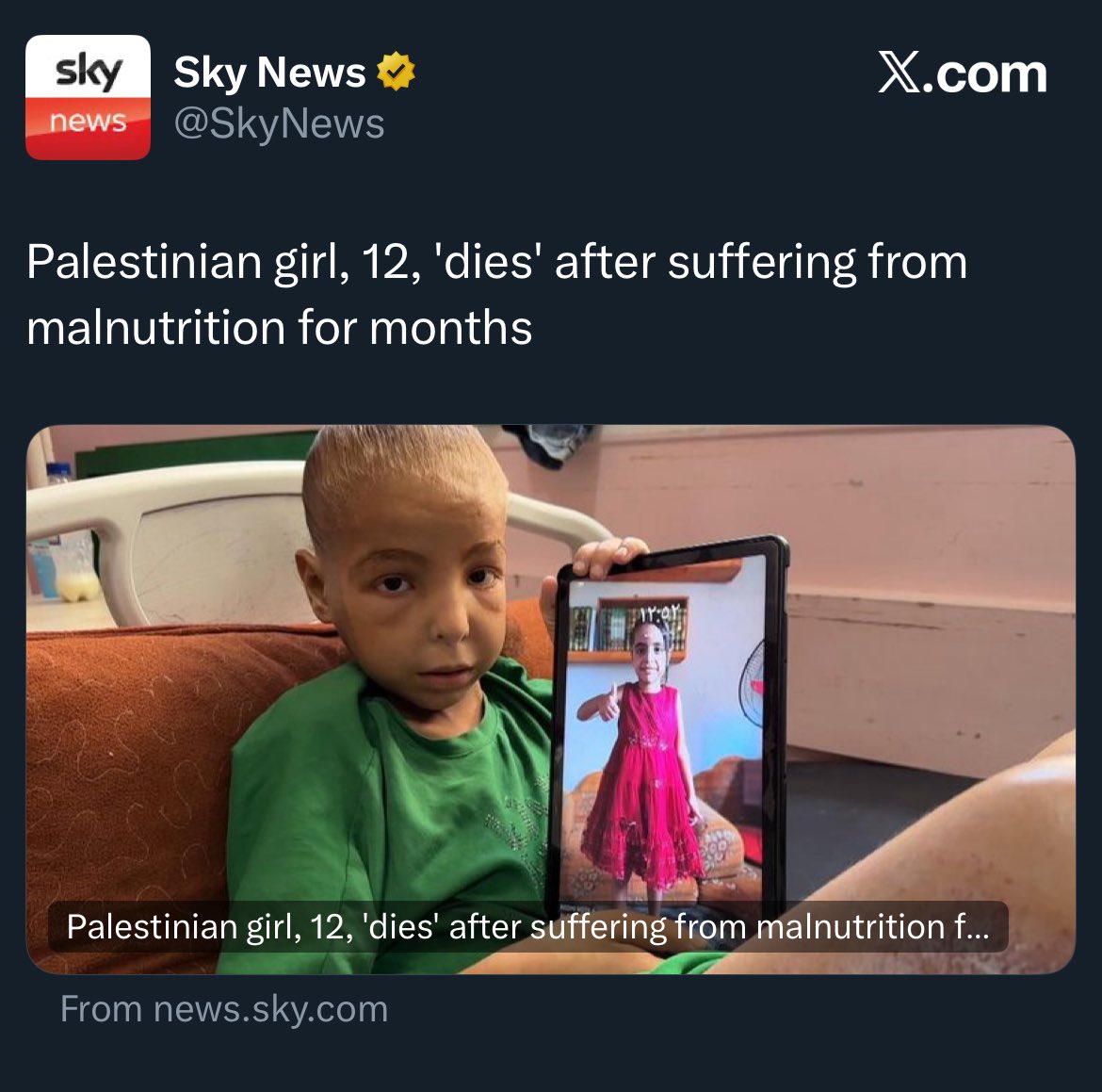 i mean sky news deleted a tweet where they put dies in quotations when talking about a child who starved to death, wtf is wrong with people man
