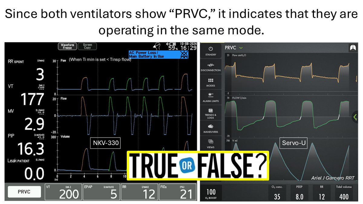 Ariel J Garnero (@arielg_rrt) on Twitter photo What do you think based on what you observe in the graphics? <a href="/emireles_c/">Eduardo Mireles-Cabodevila</a> <a href="/CCF_PCCM/">CCF Pulmonary and Critical Care Fellows</a> <a href="/ventilacionmeca/">Fede Gordo-Vidal</a> <a href="/DocMusician/">Doc Musician</a> <a href="/ventilacionmeca/">Fede Gordo-Vidal</a> <a href="/Vent_Busters/">VentBusters</a> <a href="/critconcepts/">Critical Concepts</a> <a href="/IM_Crit_/">IMCrit</a> <a href="/SaudiRTs/">Saudi Respiratory</a> <a href="/RespiratorySCCM/">SCCM Respiratory Care Section</a> What do you think based on what you observe in the graphics? <a href="/emireles_c/">Eduardo Mireles-Cabodevila</a> <a href="/CCF_PCCM/">CCF Pulmonary and Critical Care Fellows</a> <a href="/ventilacionmeca/">Fede Gordo-Vidal</a> <a href="/DocMusician/">Doc Musician</a> <a href="/ventilacionmeca/">Fede Gordo-Vidal</a> <a href="/Vent_Busters/">VentBusters</a> <a href="/critconcepts/">Critical Concepts</a> <a href="/IM_Crit_/">IMCrit</a> <a href="/SaudiRTs/">Saudi Respiratory</a> <a href="/RespiratorySCCM/">SCCM Respiratory Care Section</a>
