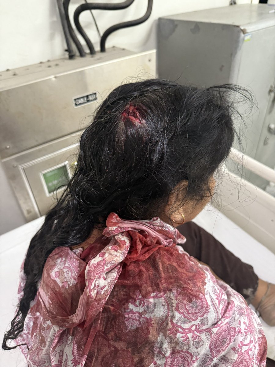 danish786saifi1's tweet image. गाँव असगरपुर से-128, थाना से-126, नोएडा में बदमाशों द्वारा पुस्तैनी ज़मीन पर 14-10-2025 रात 1 बजे अवैध हथियारो से जबरन कब्जा करने की कोशिश में प्लॉट मालिको पर जान लेवा हमला किया| @noidapolice @dcpnoida @YamunaIPS @CMOfficeUP