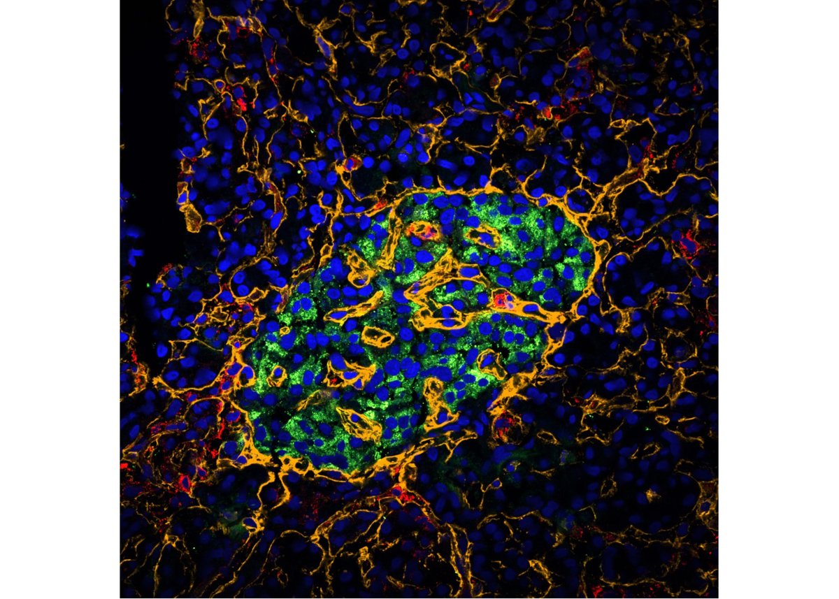 Using single-cell analysis and imaging, scientists in Professor Luc Teyton’s lab have identified a new cell type—vascular-associated fibroblastic cells (VAFs)—that protects insulin-producing cells from immune attack in type 1 diabetes.

“Identifying these VAFs is an exciting step